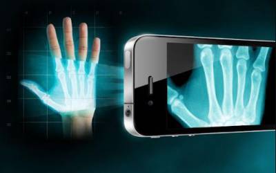 اسکن اشعه ایکس با گوشی هوشمند: رویایی که به واقعیت پیوست!